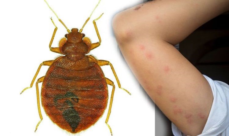 an image of what bed bug bite looks like