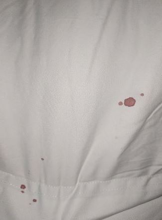 bed bug poop stains